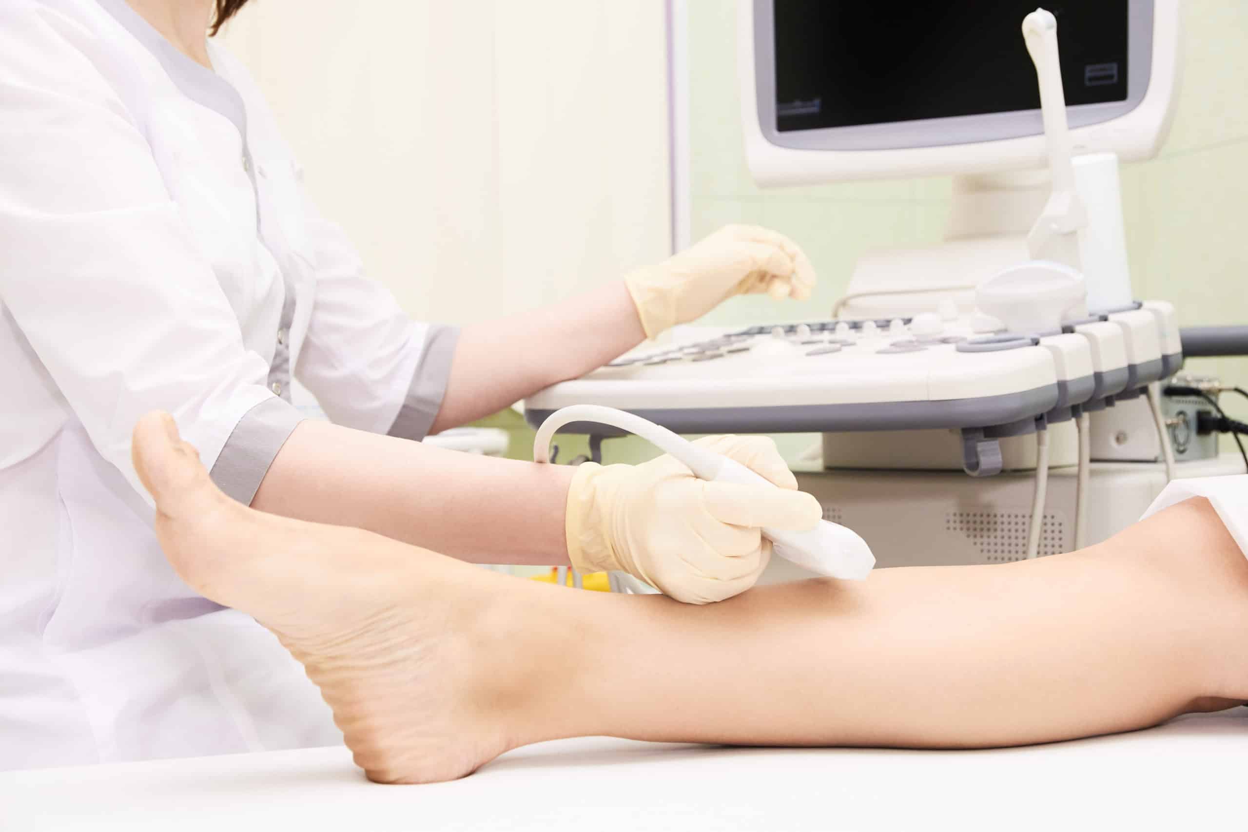 doctor examining veins on a leg