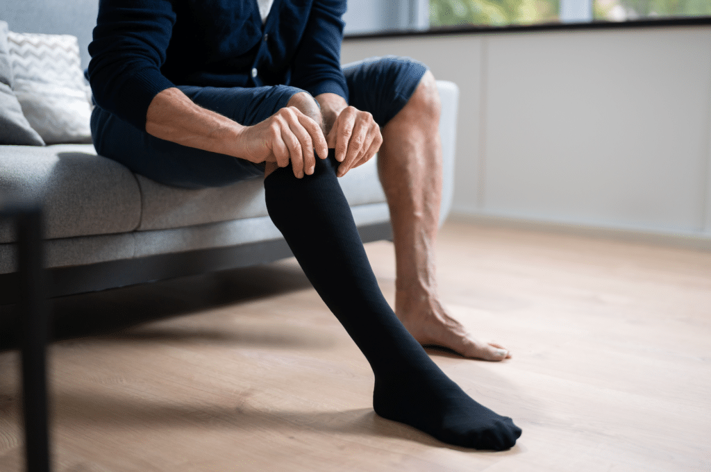 What Is Varicose Vein Ablation? A Beginner’s Guide - My Vein Treatment