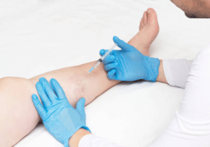 doctor injecting leg veins